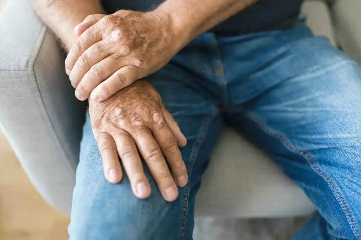 An older man&rsquo;s hands resting on his knee while seated